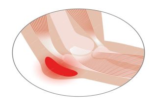 https://ayurved.harbors.in/wp-content/uploads/2023/12/diseases-joint-pain-bursitis-320x213.jpg