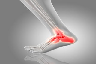 https://ayurved.harbors.in/wp-content/uploads/2023/12/diseases-joint-pain-heel-pain-320x213.jpg